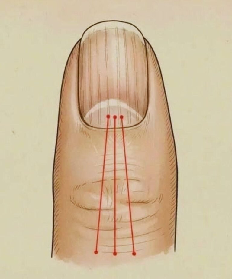 If You Notice Vertical Lines on Your Nails, It’s a Sign of This Common Body Change—What Your Hands Are Trying to Tell You!