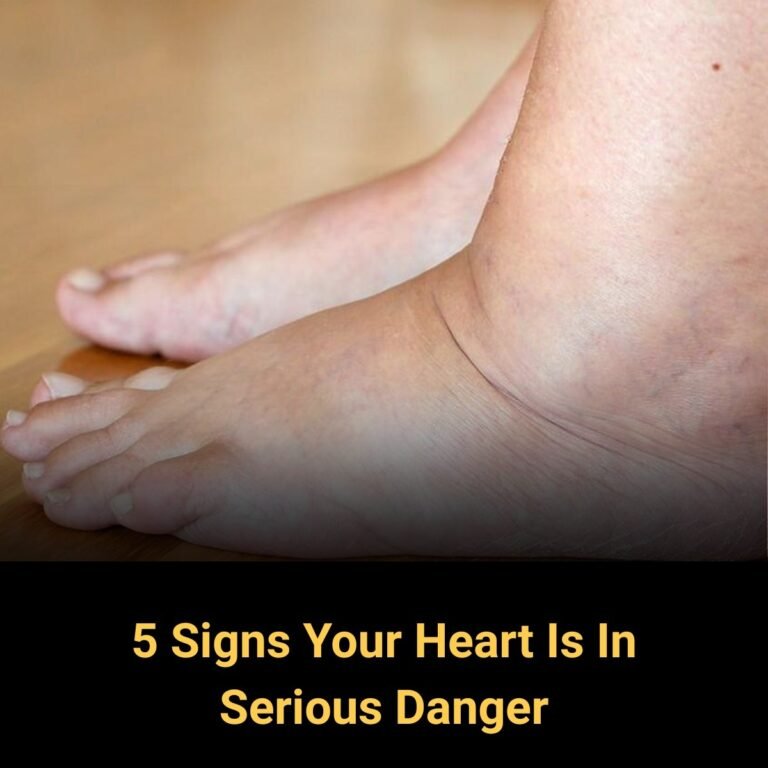 5 Signs Your Heart Is in Serious Danger (That Most People Completely Ignore)