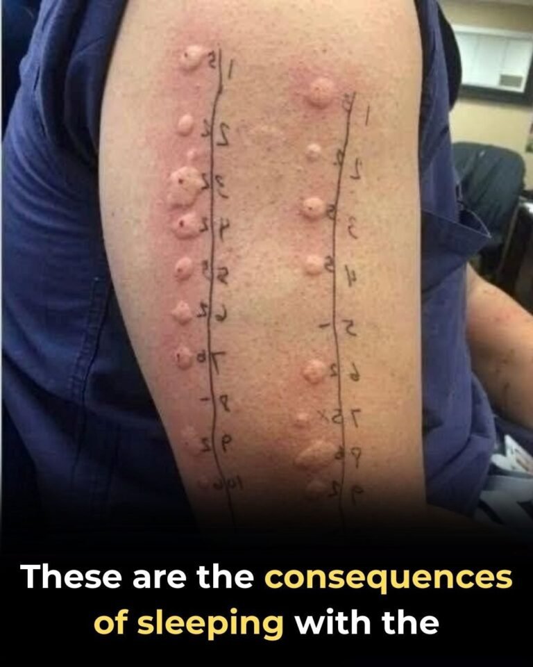 The Truth About Allergy Testing: Sorting Fact from Viral Fiction