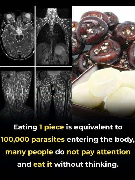 Debunking Viral Health Myths: The Reality Behind “Parasite” Claims