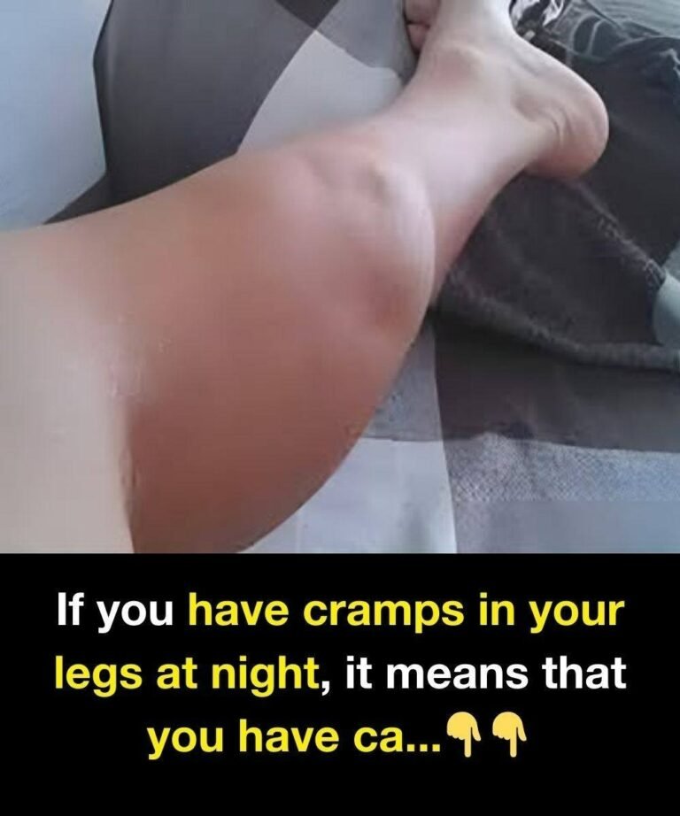 The Nighttime Wake-Up Call: The Real Reasons Your Legs Cramp and How to Fix It