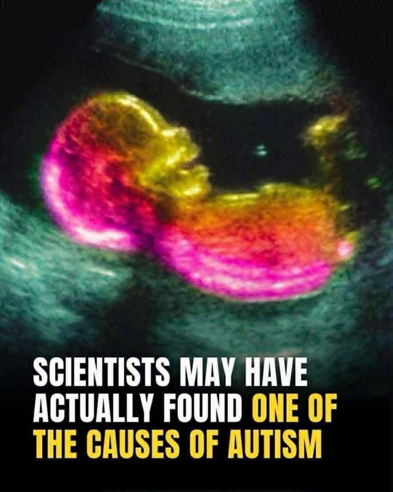 Scientists May Have Found a Link to the Roots of Autism: What It Really Means for Families