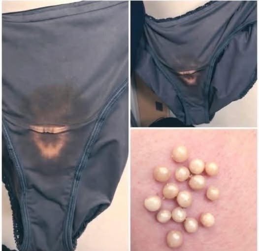 The “Pearl” Myth: Debunking Viral Underwear Clickbait