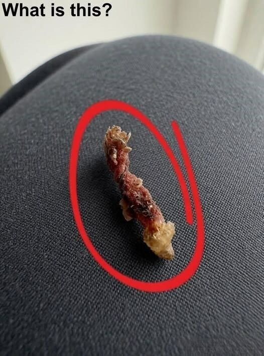 I Felt Something Crawling on My Back in Bed — But the Truth Was Much Less TerrifyingThe Midnight Mystery: What Was In My Bed? (Plus, The Ultimate Candied Bacon Recipe!)I Felt Something Crawling on My Back in Bed — But the Truth Was Much Less Terrifying