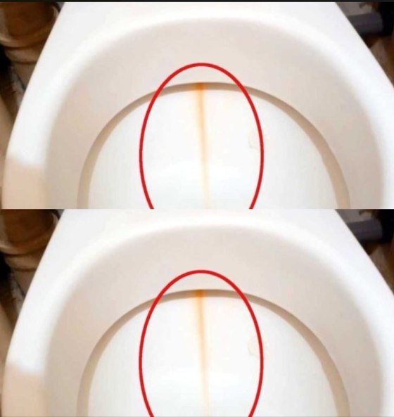 🚽 The Magic Rim Erader: How to Melt Away Stubborn Toilet Rust Streaks