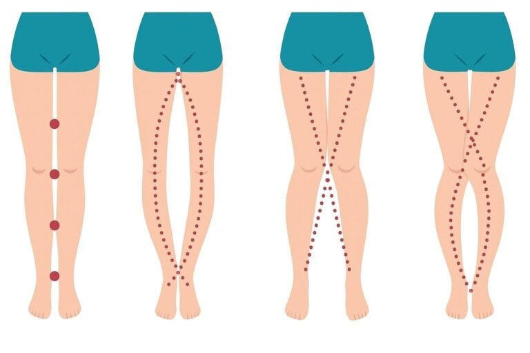 Body Language or Just Anatomy? The Truth Behind the Viral “Leg Shapes” Trend