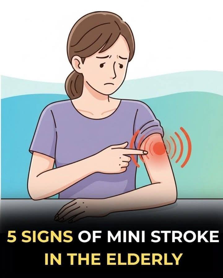Recognizing a Transient Ischemic Attack (TIA): 5 Warning Signs of a “Mini-Stroke”