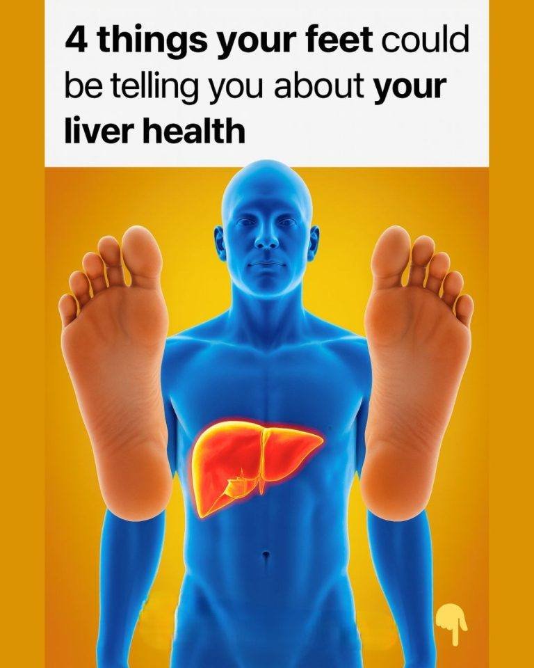 Beyond the Core: 4 Signs Your Feet Are Signaling a Liver Issue
