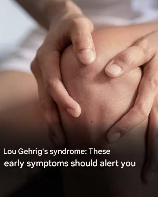 🧠 Understanding ALS: The Earliest Warning Signs of Lou Gehrig’s Disease