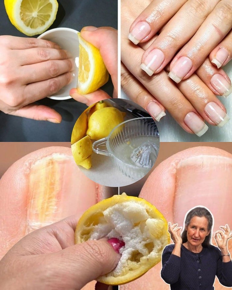 A simple and natural routine for healthier toenails