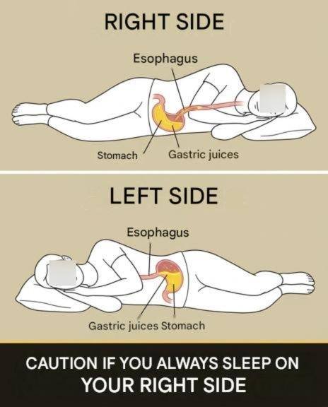 Note that if you always sleep on your right side, you should have