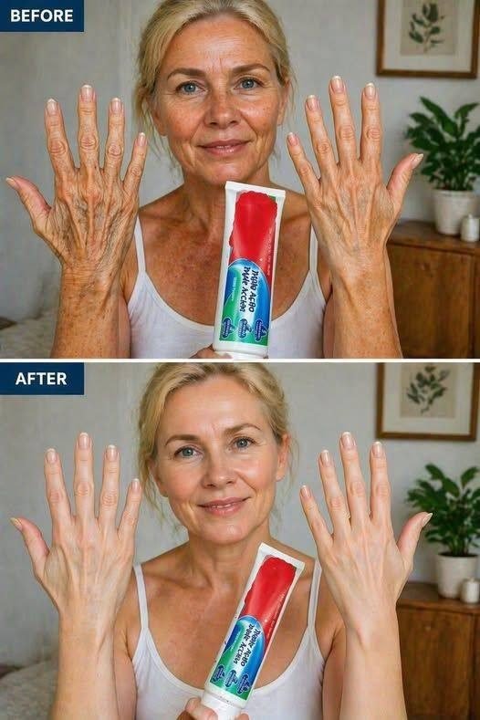 Could A Simple Kitchen Ingredient Like This Help Fade Wrinkles And Dark Spots On Your Hands And Arms