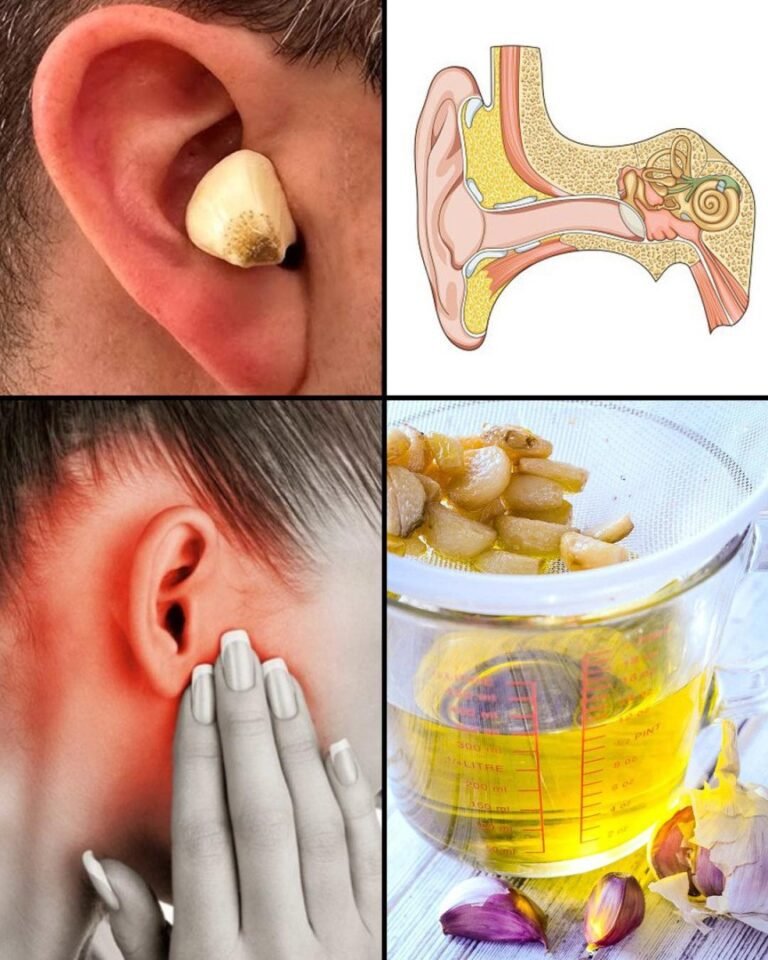 Garlic for ear health Natural relief and protection