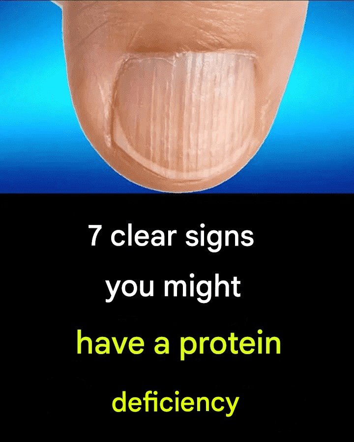 7 clear signs that you may have a protein deficiency