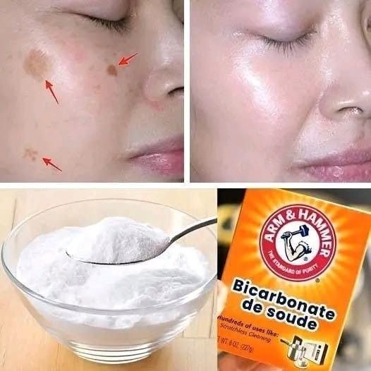 How to Use Baking Soda to Remove Dark Spots, Wrinkles, and Dark Circles from Your Face