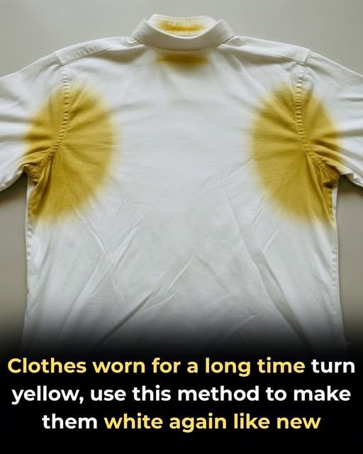 Restore Your Whites: How to Fix Yellowed Clothes and Make Them Look New Again