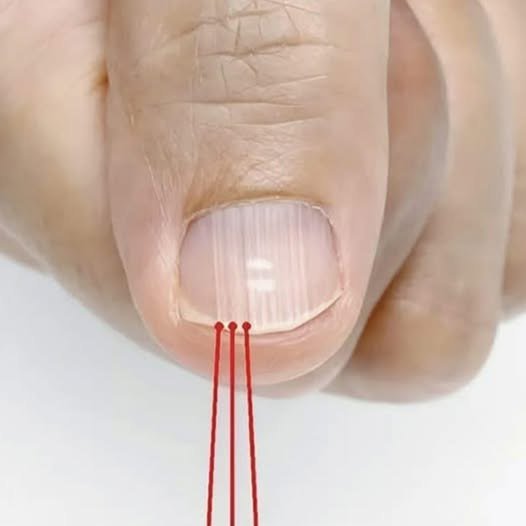 What Those Vertical Lines on Your Nails Really Reveal: The Truth About Nail Health