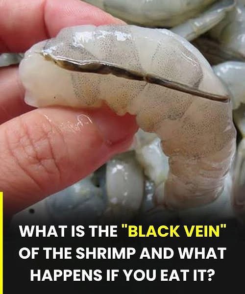 The “Black Vein” Mystery: What Are You Actually Looking At?