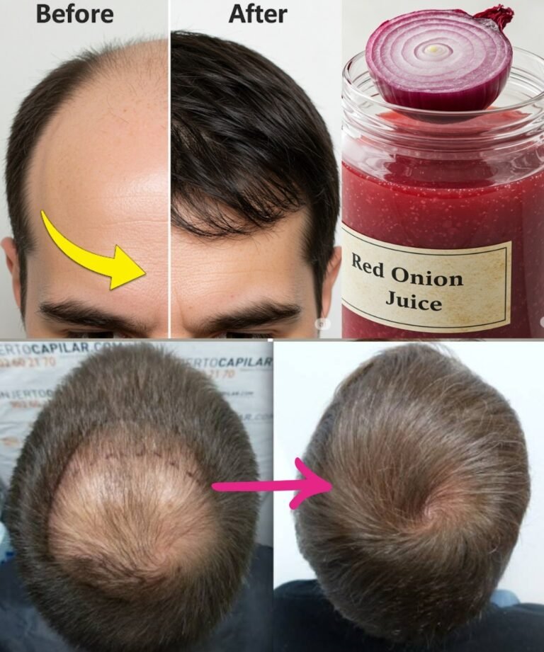 I’m shocked! With the help of this ingredient, the hair on my bald spot is growing like crazy