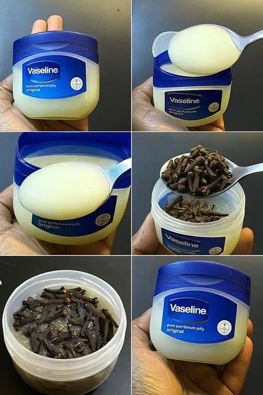 Mix cloves with petroleum jelly a secret no one will ever tell you Thank me later