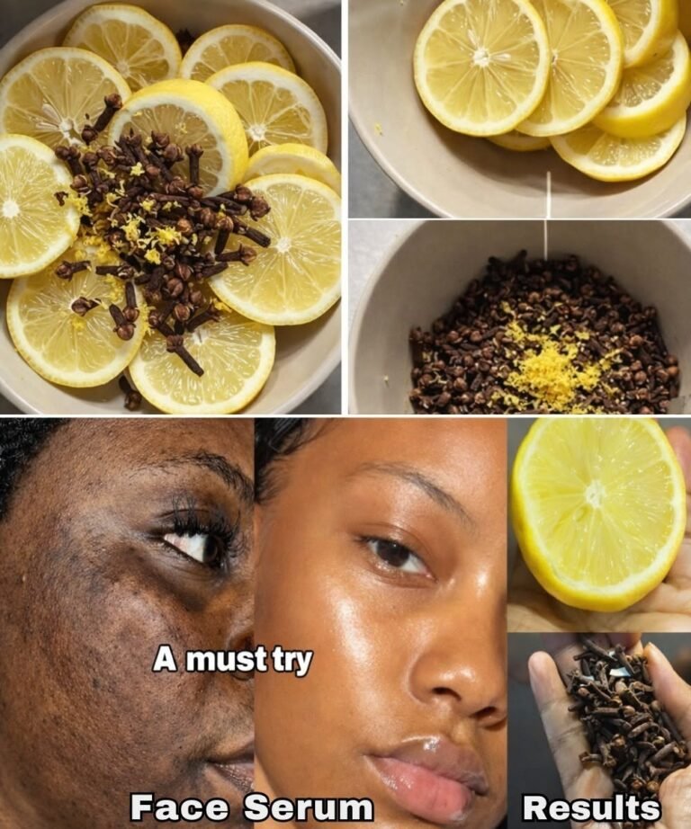 Mix Clove with Lemon to look younger than your age clear acne blemishes scars & get a glowing skin