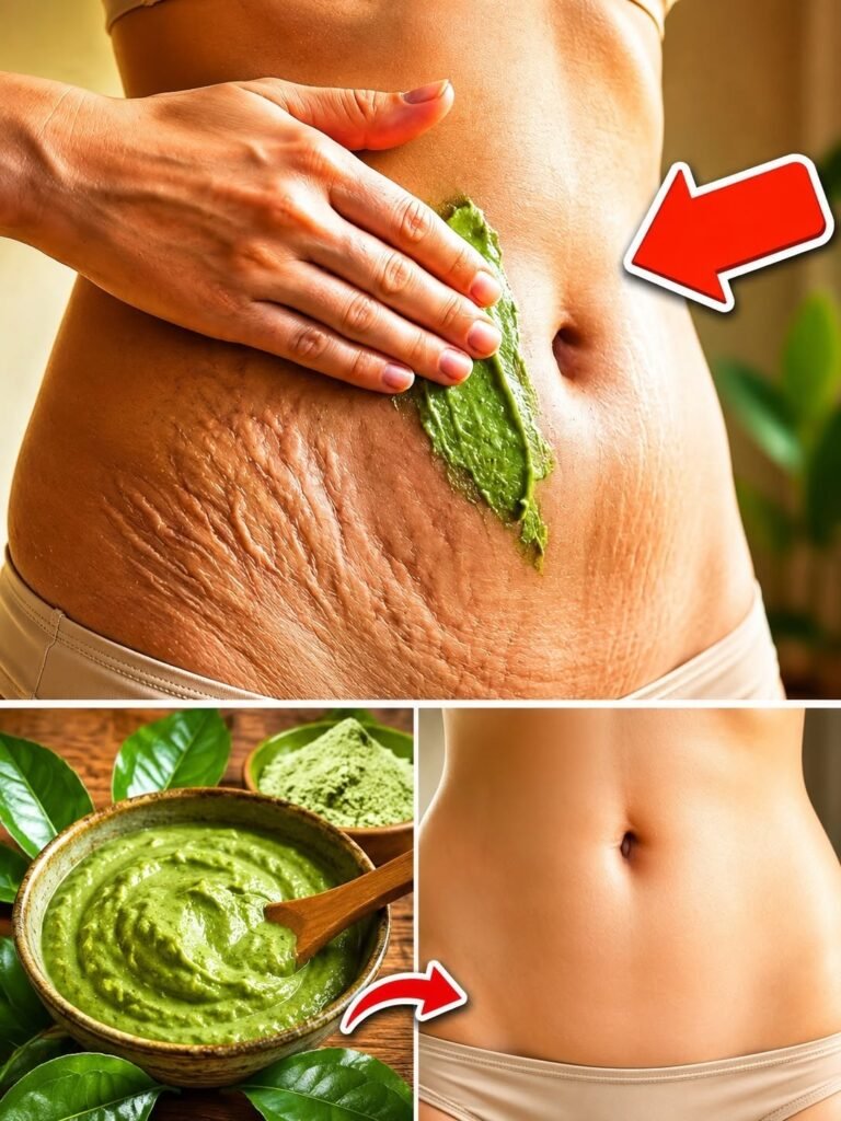 Use this product to erase stretch marks Extremely fast