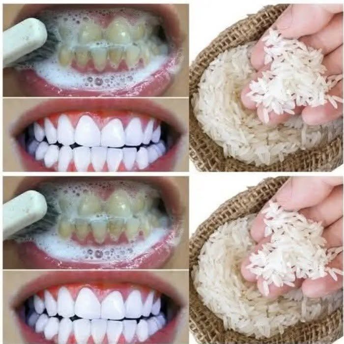 Whiten your teeth in just 1 minute with this simple home trick