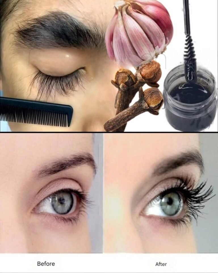 Garlic and clove remedy for naturally longer and thicker eyelashes.