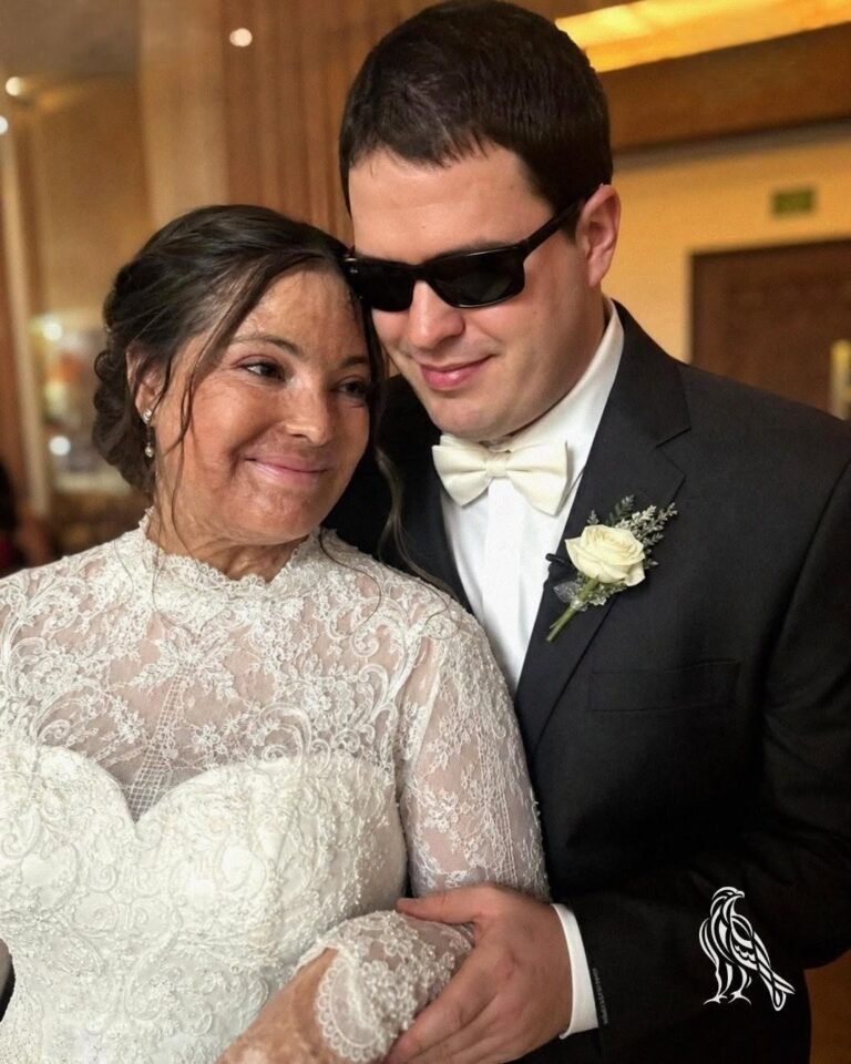 I Married a Blind Man So He’d Never See My Scars