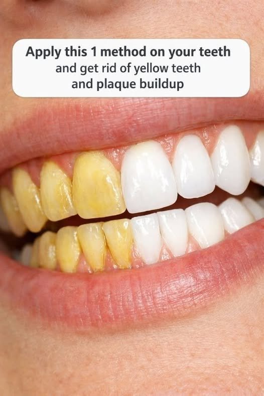 A Simple Dental Care Method That May Help Reduce Plaque Buildup