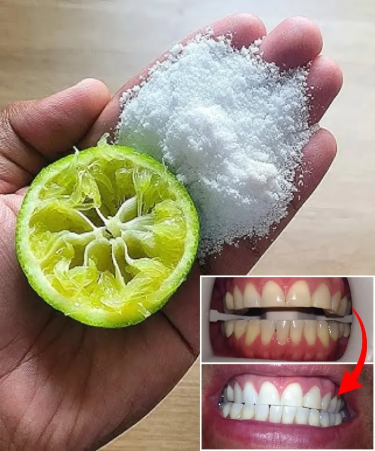 Unlock a Dazzling Smile: Natural Teeth Whitening Secrets You’ll Wish You Knew Sooner