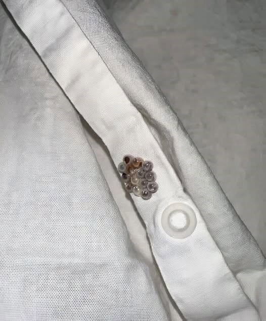 I found these tiny balls in my bed and nearly had a heart att.ack: here’s what they were