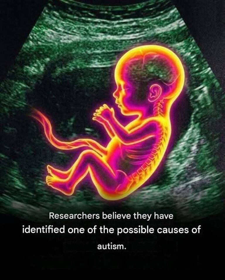 A study highlights a possible link with the development of autism…