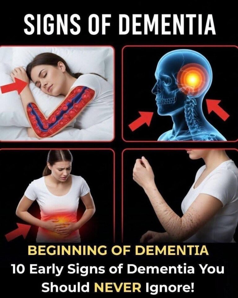 10 Early Signs of Dementia You Should NEVER Ignore!….