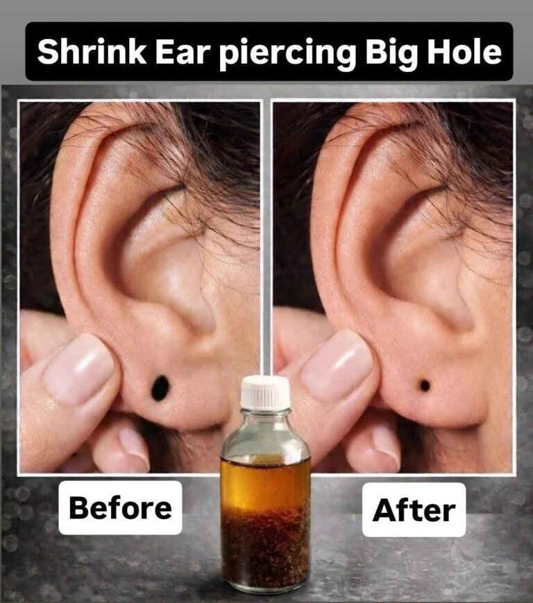 Shrink Dropping Earlobes Naturally At Home