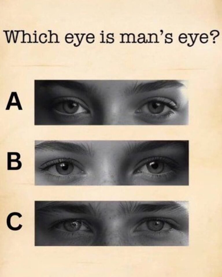 Which eye is man’s eye?