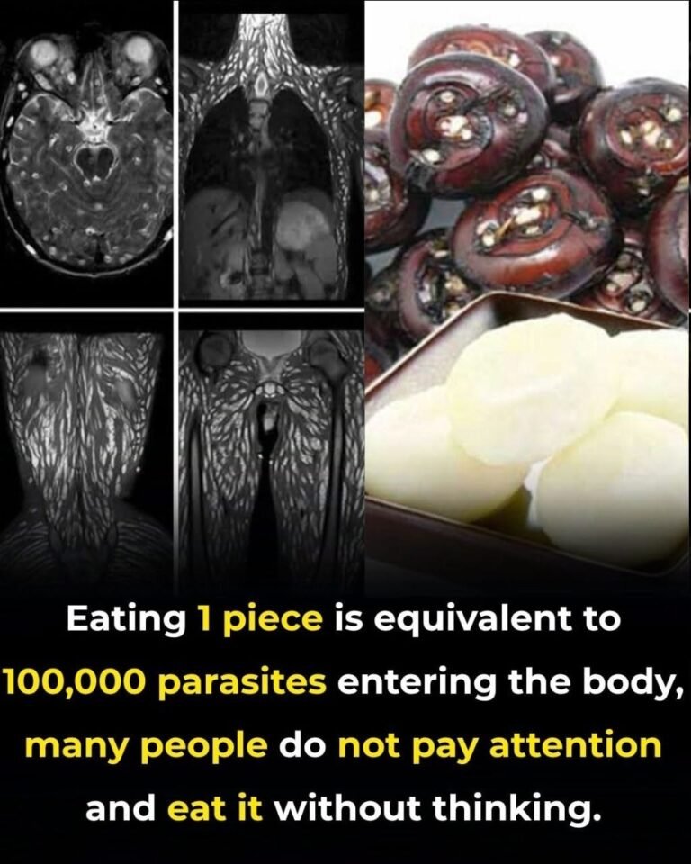 Eating Just One Bite Can Be Harmful: How to Protect Yourself from Foodborne Parasites