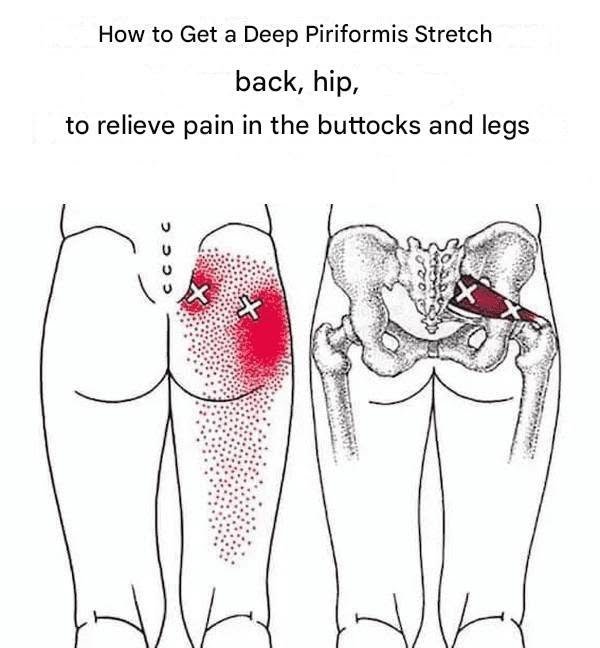 How to Get a Deep Piriformis Stretch to Eliminate Back, Hip, Glutes, and Leg Pain